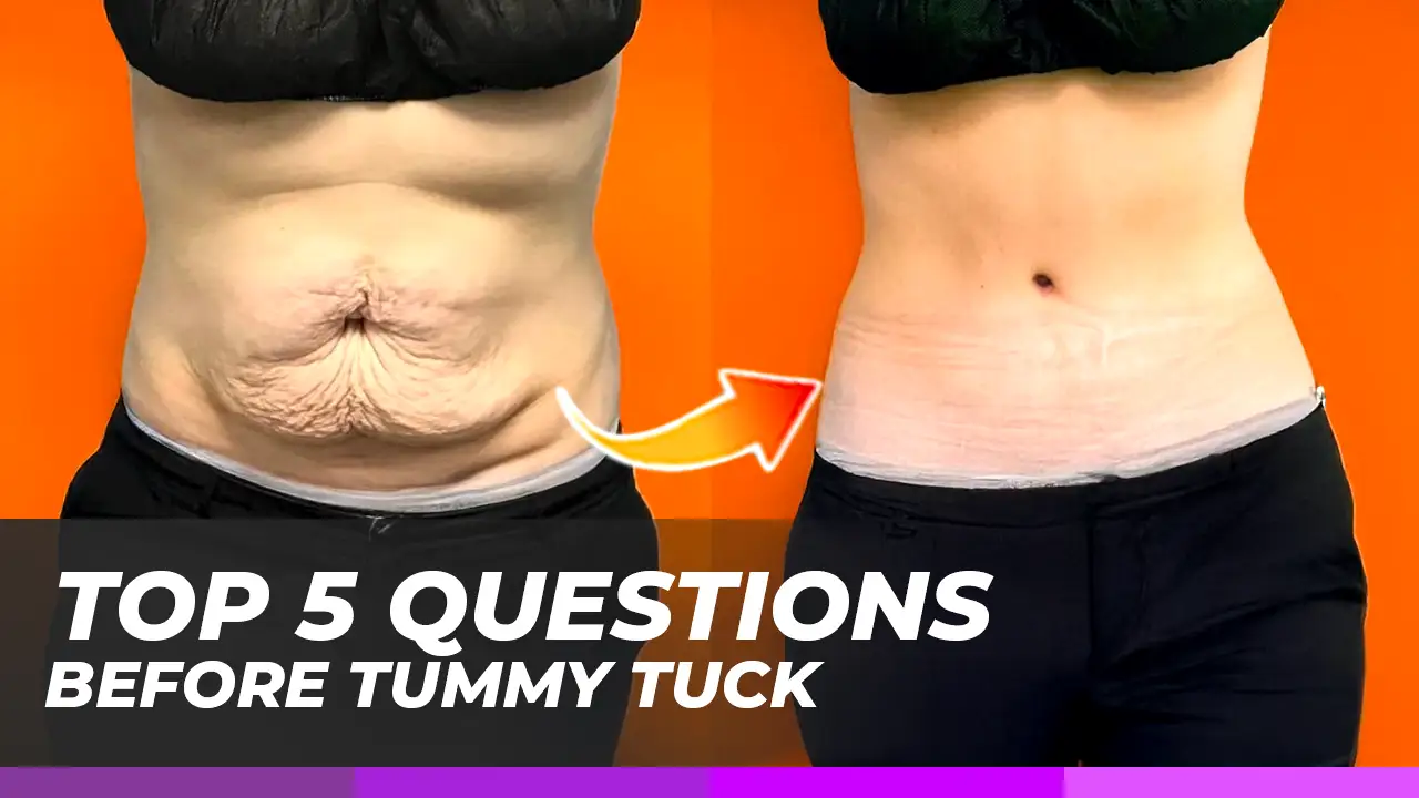 Top 5 Questions Before a Tummy Tuck in Turkey (2026)